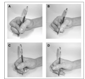 Four photos labeled A to D of hands holding a pencil in different grasp patterns
